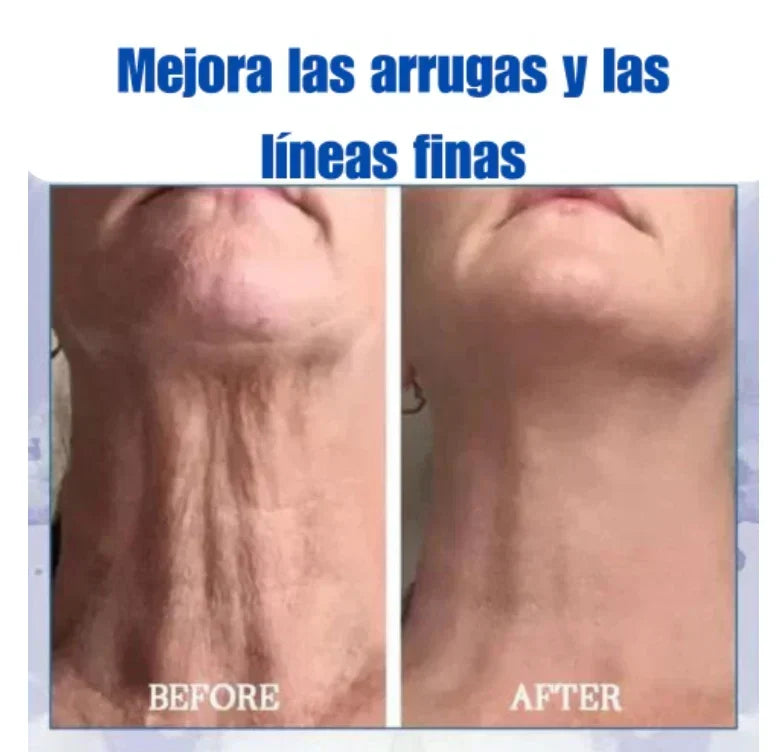 ✨🩵𝟕𝟎% 𝐎𝐅𝐅🌸𝐅𝐮𝐛𝐬𝐭𝐚® -Recupera la elasticidad de la piel⭐ 300ML