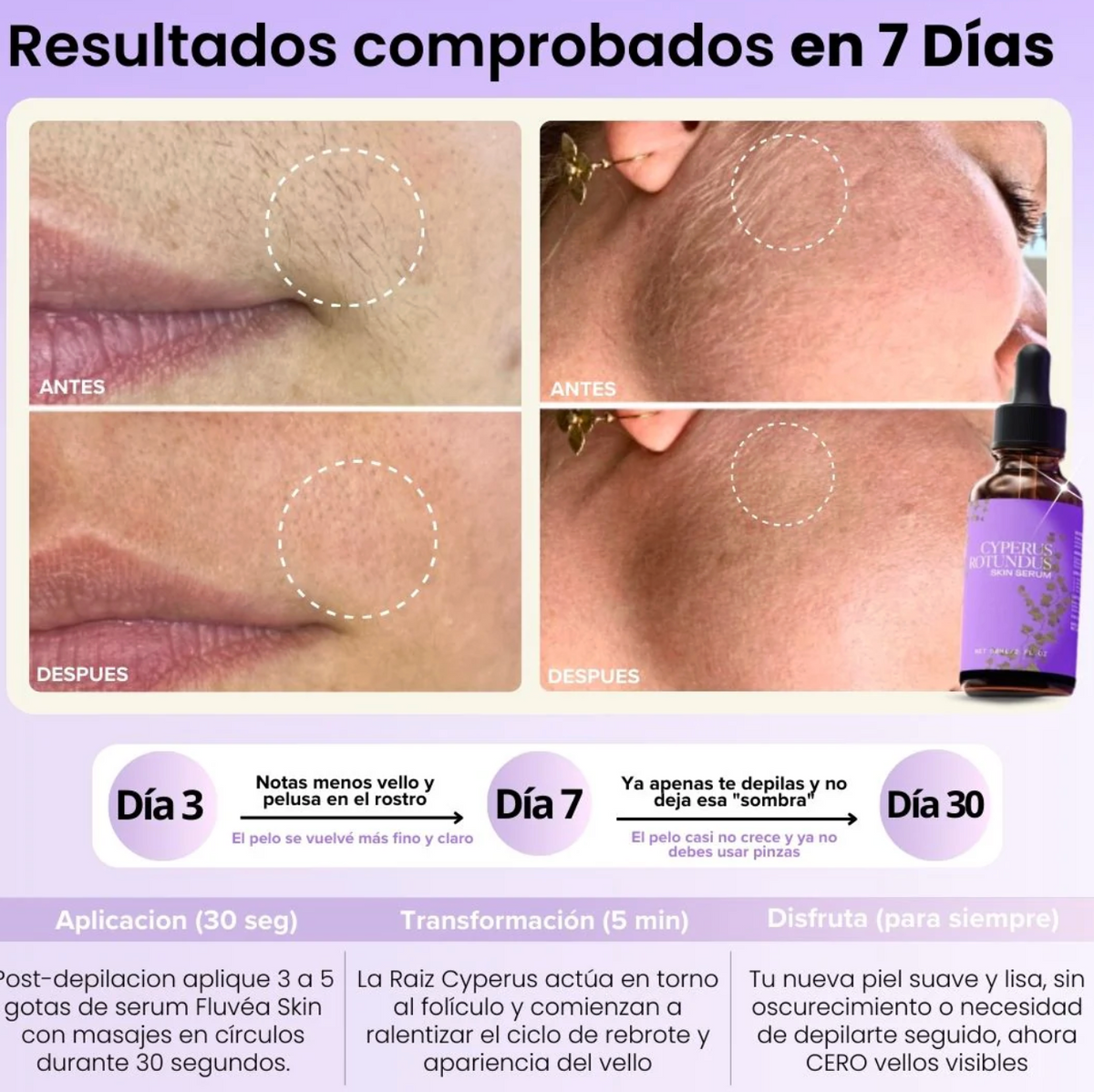 FluvéaSkin® - Vello más fino y menos visible con Raiz de Cyperus Rotundus