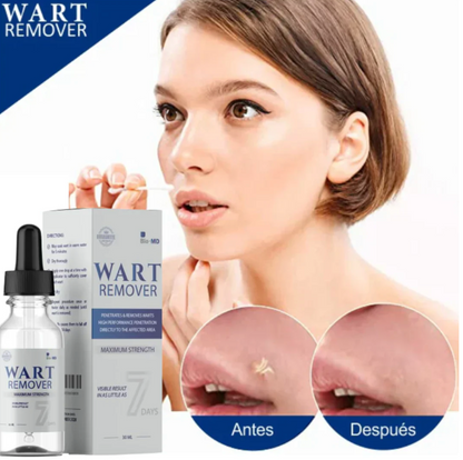 Wart Remover | Removedor de verrugas y lunares OFERTA 2X1 ✅